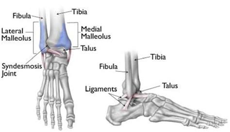 Lateral Malleolus Fracture