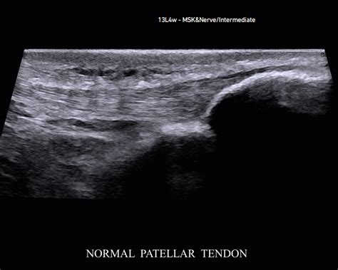 Ultrasound Machines for Orthopedics and Musculoskeletal | BK Medical