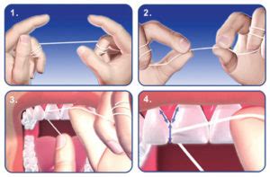 Why Flossing Is Important - Dr. Surya & Associates