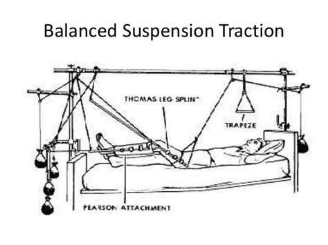 Traction