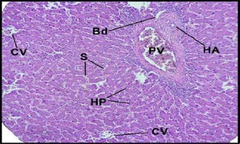 Histological section of the liver in mallard duck : Showing the portal ...