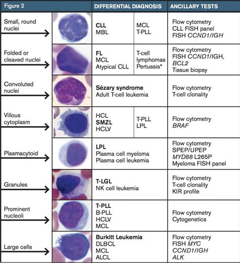 Atypical Lymphocytes Normal Range - MillaService