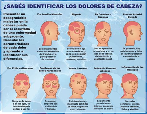 Cuadros comparativos entre los diferentes dolores de cabeza | Cuadro ...