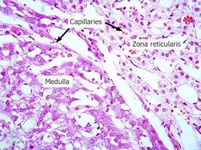 Adrenal Gland Histology - Adrenal medulla (labels) - histology slide