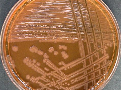 Proteus mirabilis | Proteus mirabilis, Microbiology, Petri dish