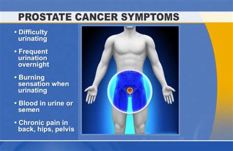 advanced-prostate-cancer-symptoms | 99 Health Ideas