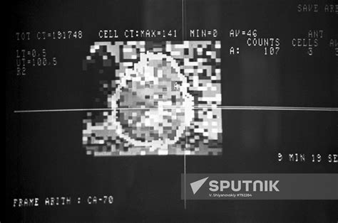 Radionuclide diagnostics | Sputnik Mediabank