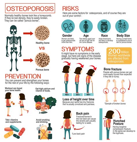 Osteoporosis Causes & Prevention | GWC Radiology