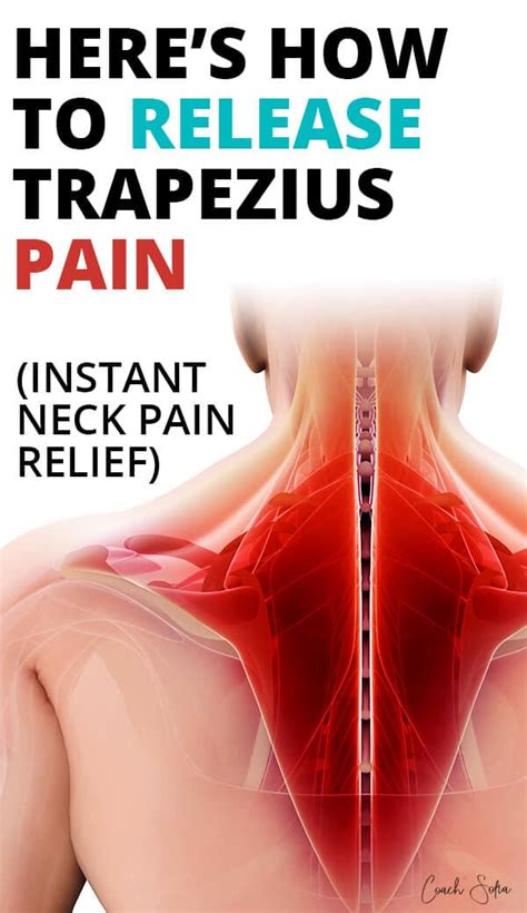 Trapezius Muscle Pain