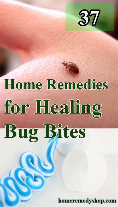 37 Home #Remedies for Healing #Bug #Bites - > #HomeRemedies #BugBites # ...