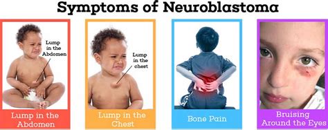 Get Bone Neoplasm Symptoms US