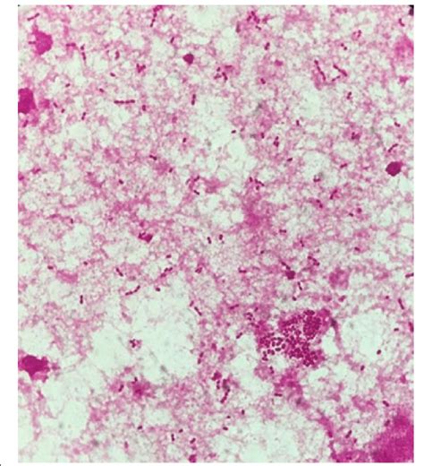 Gram Negative Cocci Blood Culture