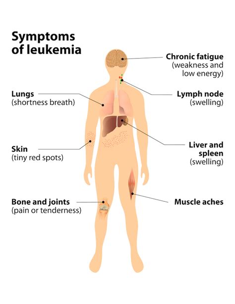 Leukemia Symptoms Skin