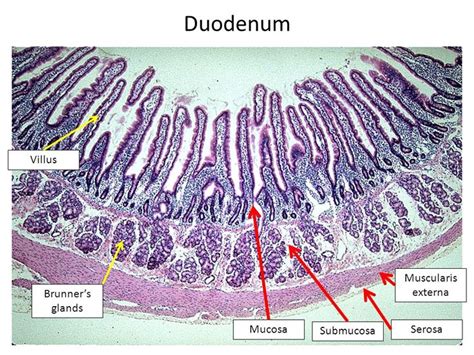 Image result for small intestine duodenum histology labeled brunner's ...