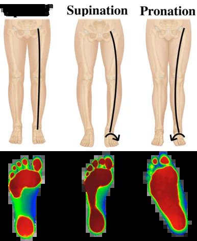 Supination of the feet