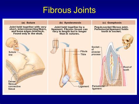 Pin on Chapter 9: Joints