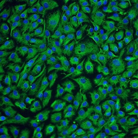 Human Nucleus Pulposus Cells - Innoprot Skeletal Cell System