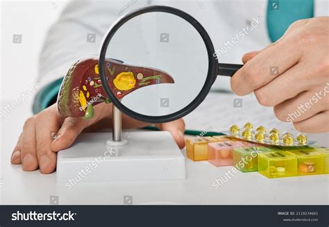 Human Liver Disease Diagnosis Liver Treatment Stock Photo 2119234661 ...