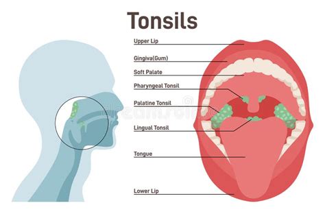 Tonsils. Human Lymphoid Organs Stock Vector - Illustration of medical ...