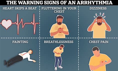 Heart Arrhythmia Symptoms