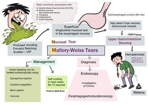 Mallory-Weiss Tears: Esophageal tear - Creative Med Doses