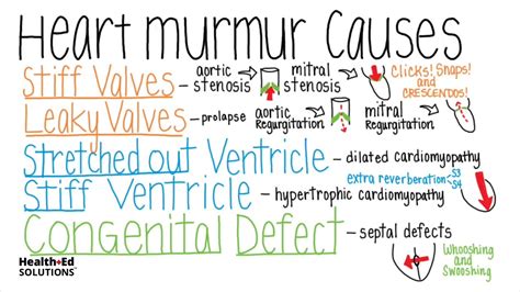 What are the Common Causes of Heart Murmurs? (Heart Murmur Series ...