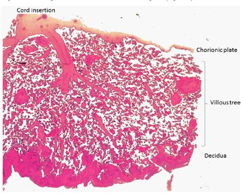 Placenta Histology Labeled