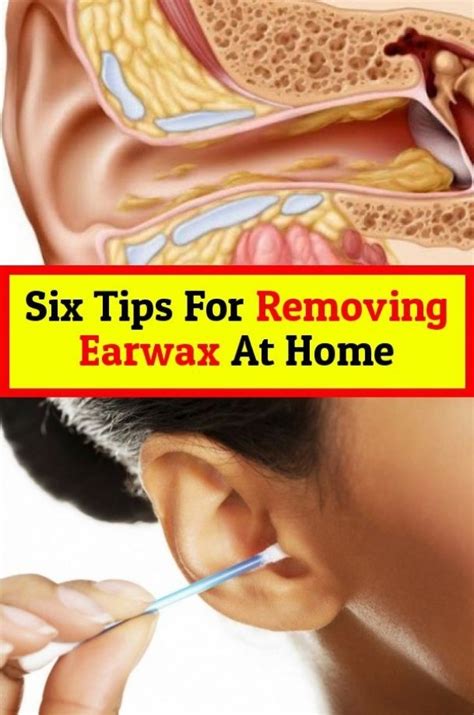 Here are six tips to remove Earwax in 2020 | Ear wax, Natural lubricant ...