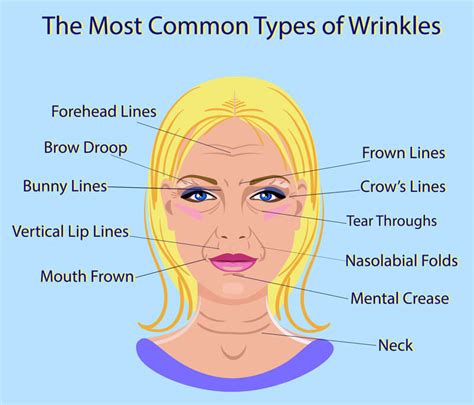 Common Types of Facial Wrinkles (Rhytides) - Westlake Dermatology