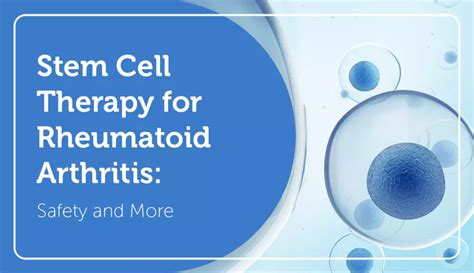 Stem Cell Therapy for Rheumatoid Arthritis: Safety and More | myRAteam