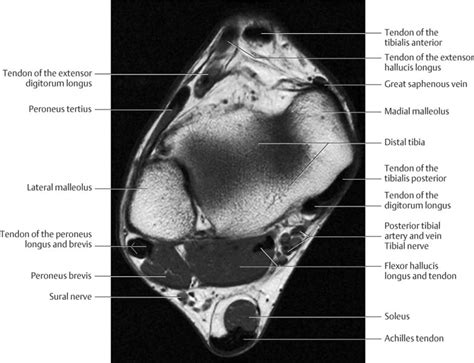 forefoot muscle anatomy mri radiology