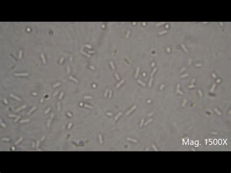 [最も選択された] e coli microscope 284026-E coli under microscope 1000x