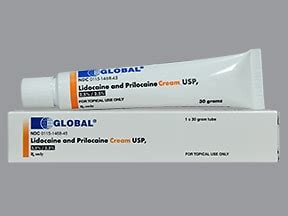 lidocaine-prilocaine topical : Uses, Side Effects, Interactions ...