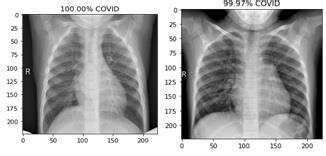 Covid-19 positive with severity in percentage | Download Scientific Diagram