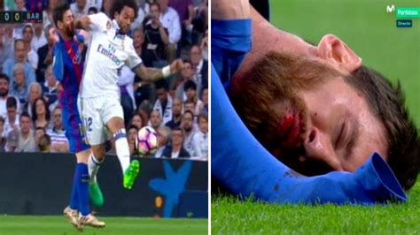 Messi suffers gruesome facial injury at the Bernabeu | MARCA in English