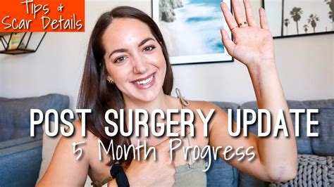 Cubital Tunnel Surgery & Release UPDATE: Physical Therapy For Fractured ...