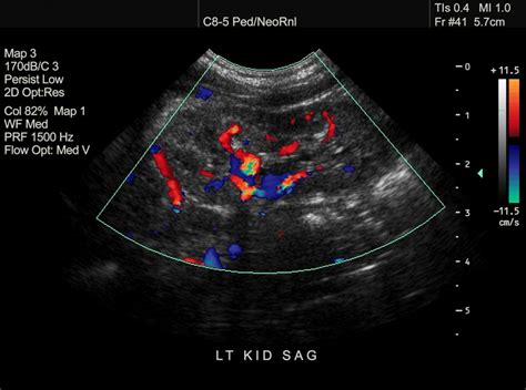 How do ultrasound scans work?