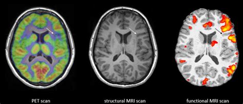 功能性核磁共振造影 (fMRI) 應用|最新文章 - 科技大觀園