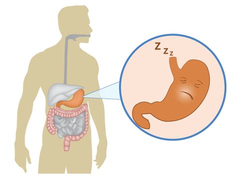 Gastroparesis | What is it and what causes it? | Signs & Treatment