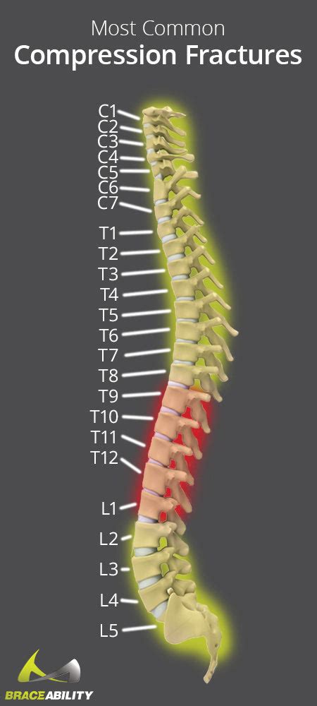 Impacted Fractures