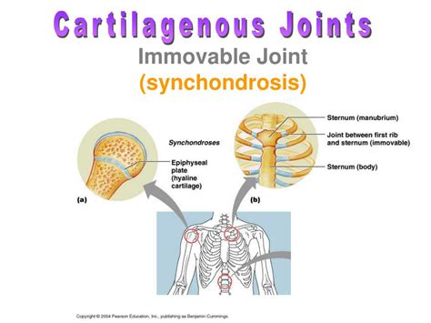 Synchondrosis And Symphyses Are Examples Of Joints / Suture of skull ...