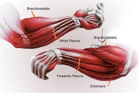 pain muscle forearm coz of sc2 : r/starcraft