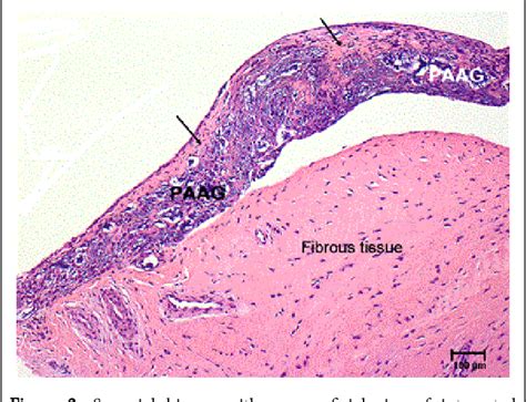 Synovial Membrane Histology