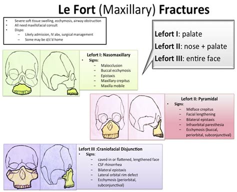 Maxillary Fracture Classification