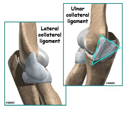 Ulnar Collateral Ligament Reconstruction (Tommy John Surgery ...