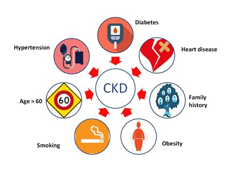 Learn about your kidneys - Trust Multispeciality Hospitals