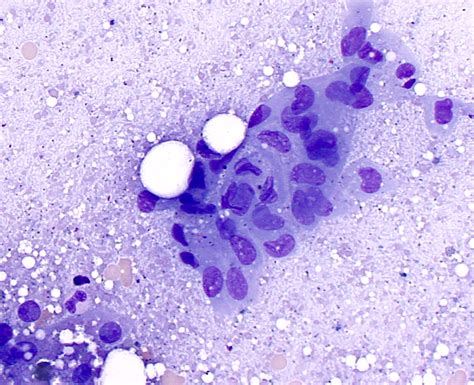 Cytology | eClinpath