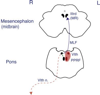 Eye Movement Disorders: Conjugate Gaze Abnormalities | Ento Key