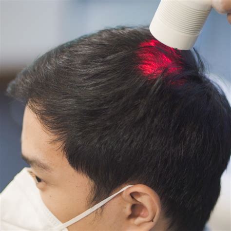 Laser Therapy for Hair Growth | Svenson