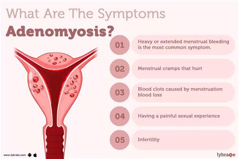 Adenomyosis - Causes, Symptoms, Treatment, Diet And Home Remedies